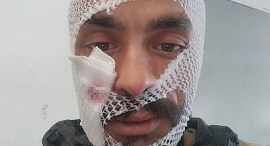 İneğinin boynuz darbeleri ile yaralanan gencin paylaşımı gülümsetti