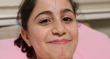 Yüz Felci Geçiren 10 Yaşındaki Çocuk Akupunktur İle Sağlığına Kavuştu